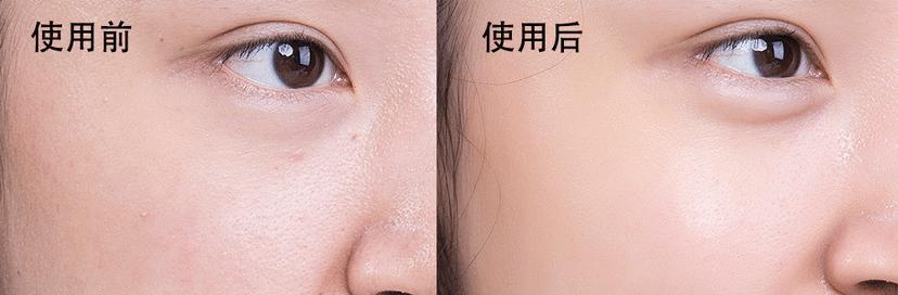 毛孔严重堵塞该如何处理？（有效的解决方案与预防方法）