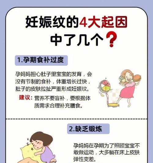 预防妊娠纹生长的有效方法（孕期护肤秘籍，告别妊娠纹）
