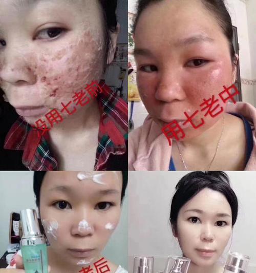 如何解决热水器开关流黄水问题（有效方法让您的热水器水质恢复清澈）
