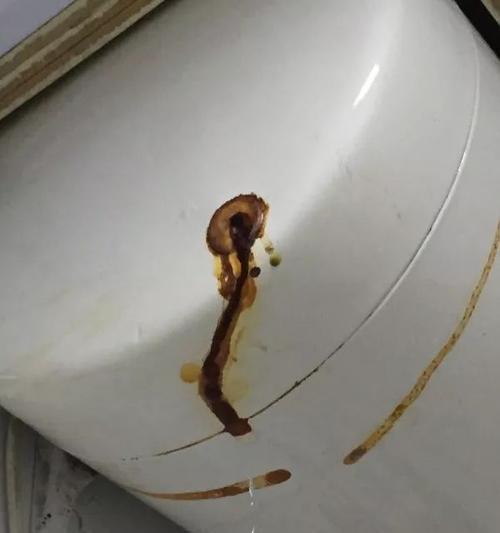 老式热水器漏水处理方法（应对老式热水器漏水问题的有效措施）