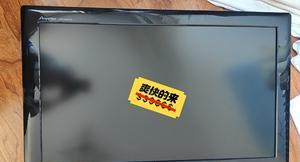 海信电视机灯条故障及解决办法（探索海信电视机灯条故障的原因与解决方案）