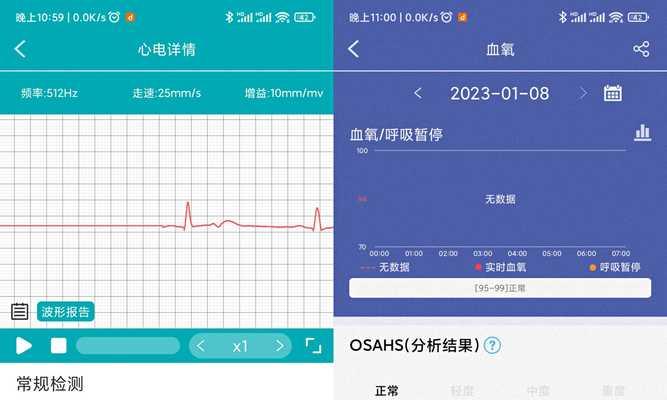 智能手表如何检测血氧饱和度？准确度如何？