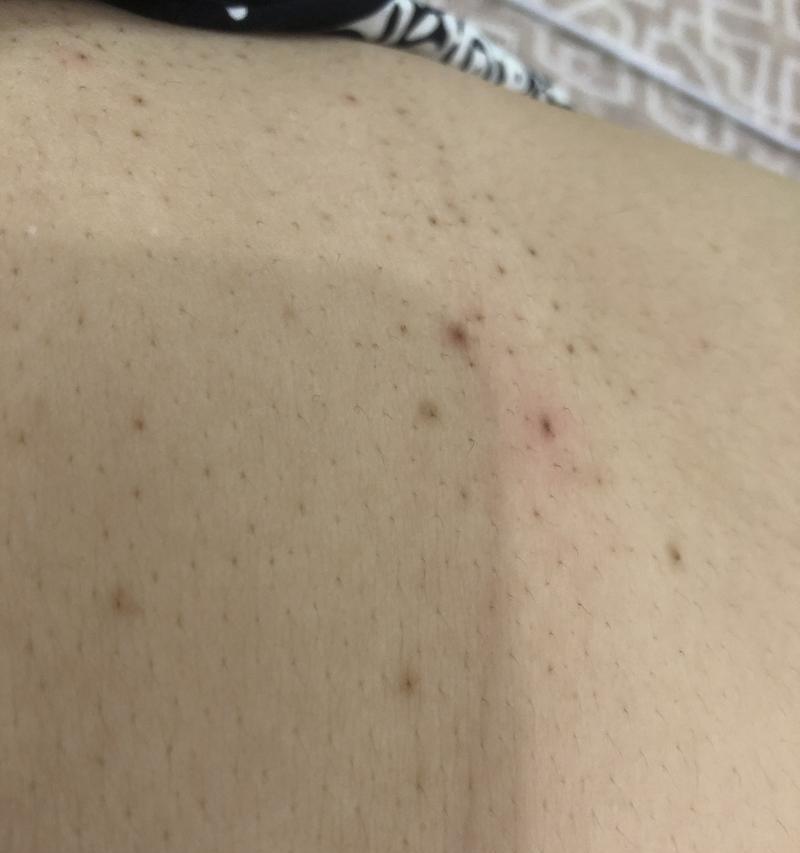 苹果手机背面出现黑点怎么办？可能的原因是什么？