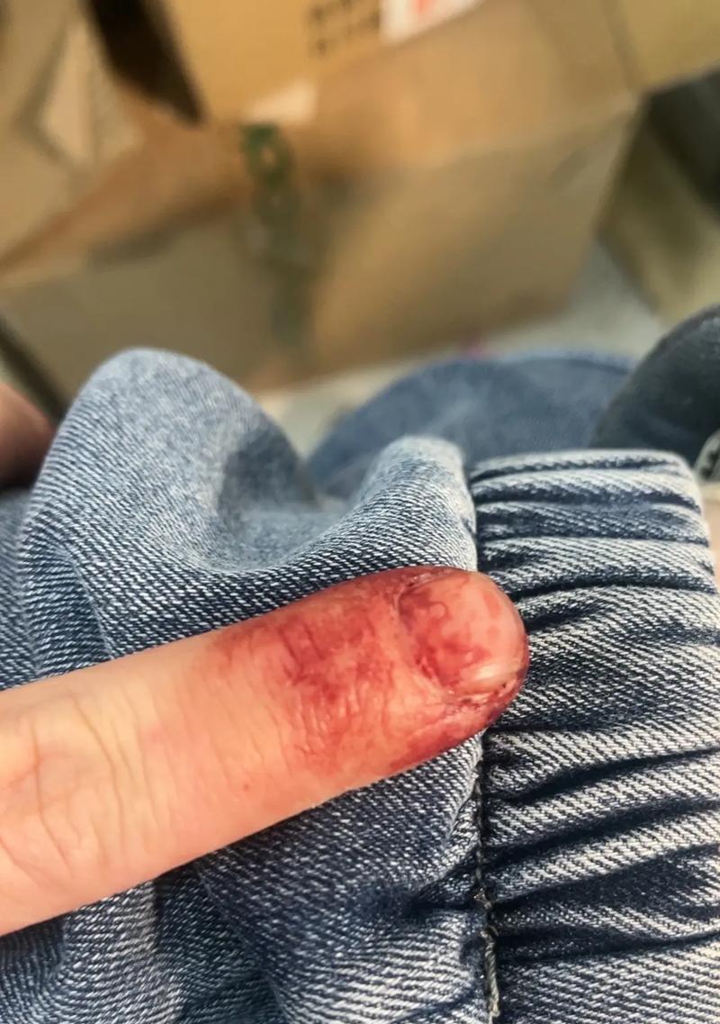 荣耀20屏幕损坏如何自行更换？更换过程复杂吗？